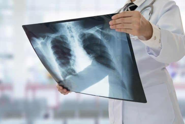 醫療廢物X射線報告銷毀 醫療廢物X射線報告銷毀